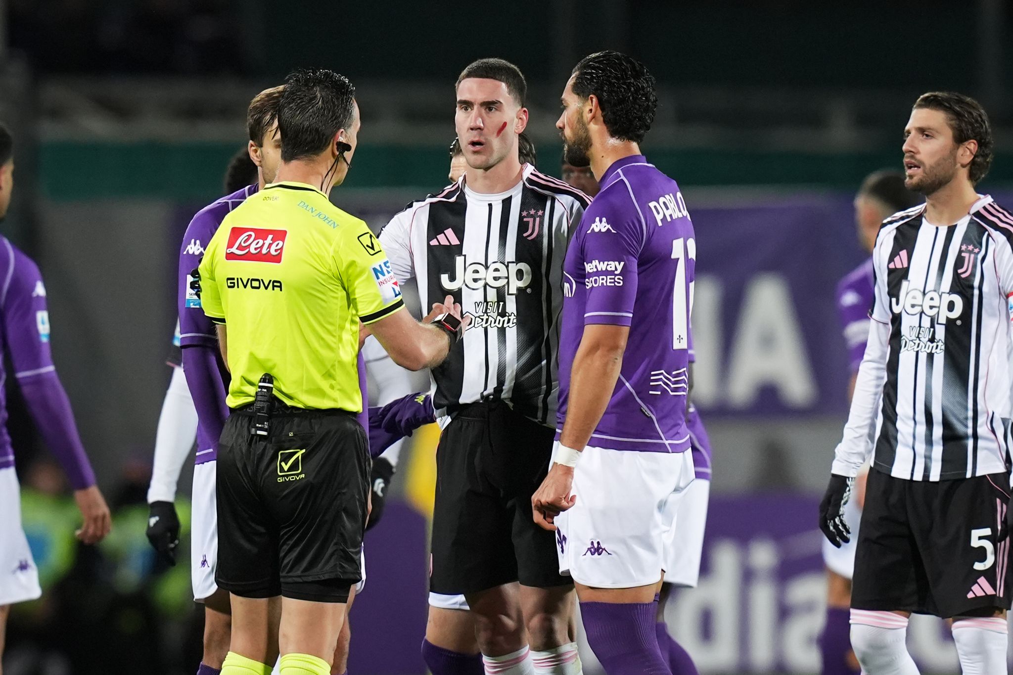Juventus-Profi rassistisch beschimpft – Spiel unterbrochen